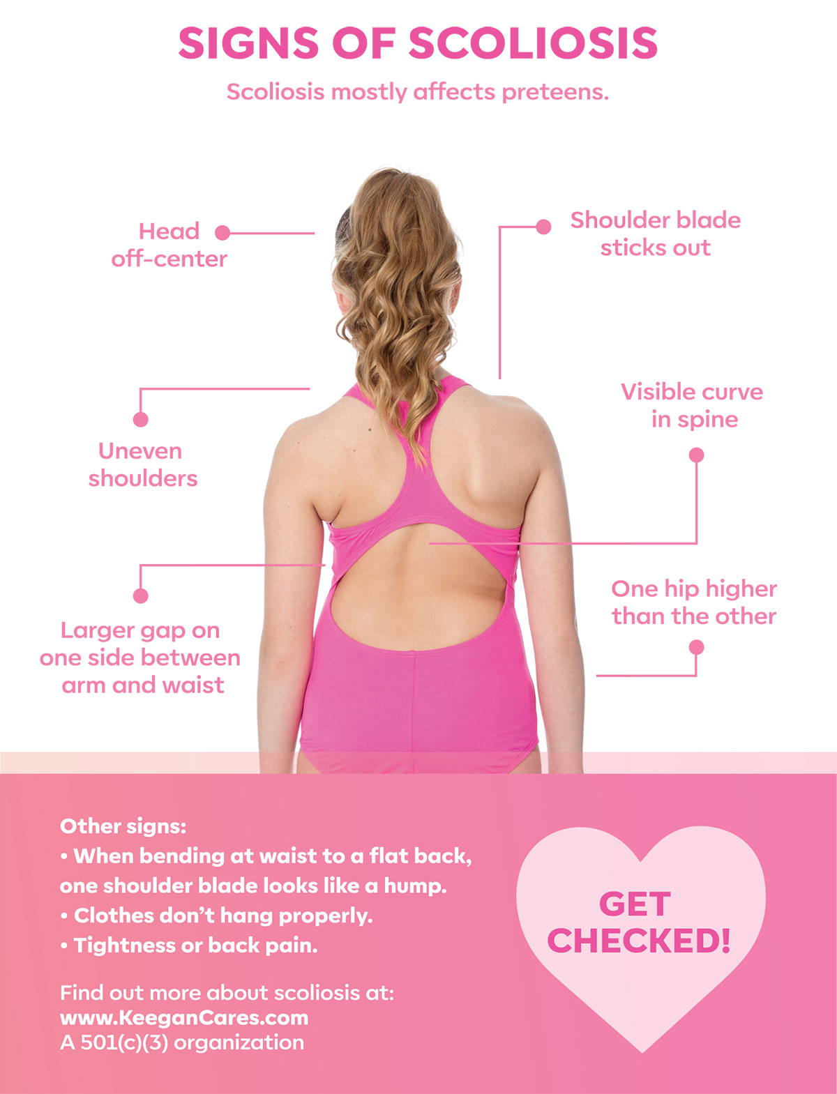 SIGNS OF SCOLIOSIS